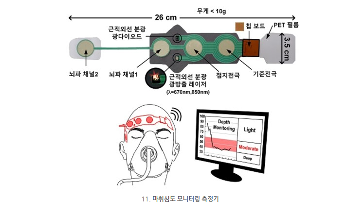 제로마취 특허22.png